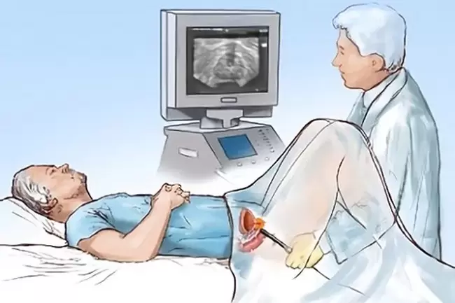 Diagnosi di prostatite